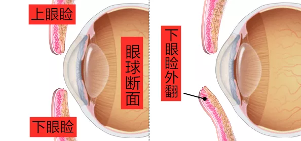 猫眼外翻的形成原因、症状及治疗