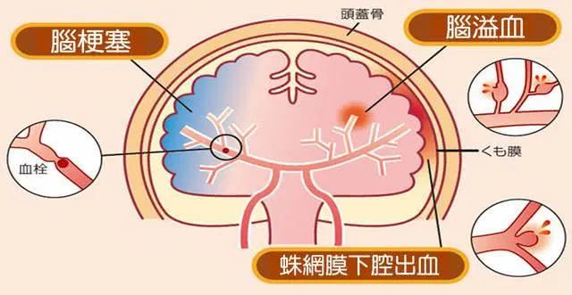 猫咪可能也会中风吗？猫咪中风了该怎么办？