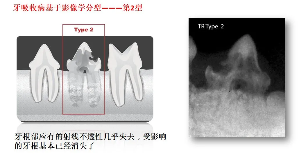 如何区分猫咪是蛀牙还是患牙吸收病？