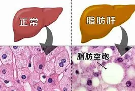 猫咪长时间不吃饭，容易得脂肪肝