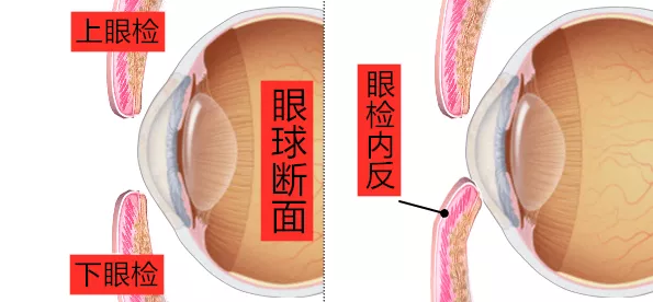 猫眼内翻的形成原因、症状及治疗